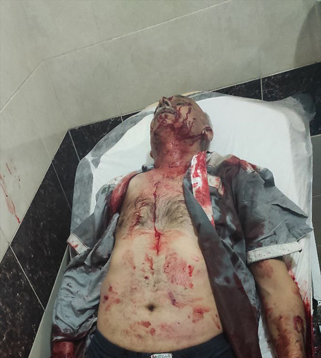 Tel Rıfat'taki YPG/PKK'lı teröristlerin Afrin'e saldırısında 2 sivil öldü, 10 sivil yaralandı