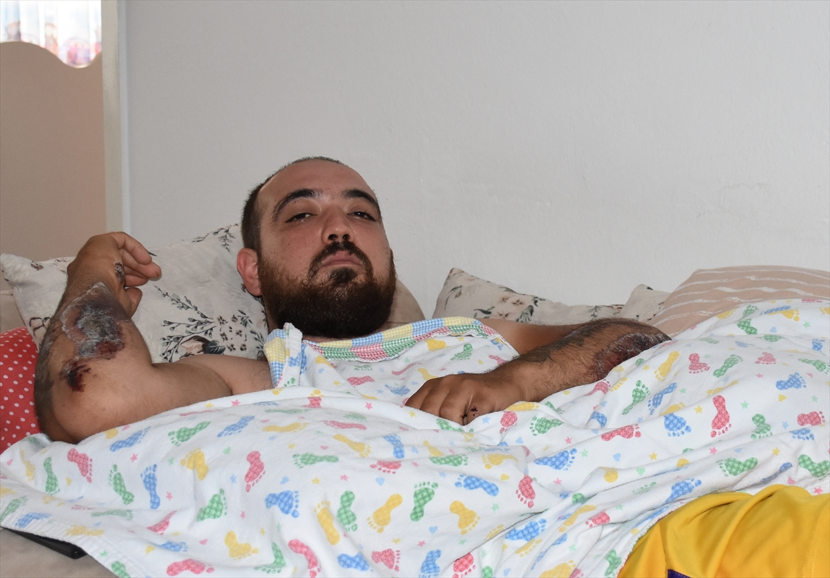 Kamyon şoförünün sıkıştırmasıyla kaza yapan motosiklet sürücüsü Karaağaç, kask takmanın önemini anlattı: