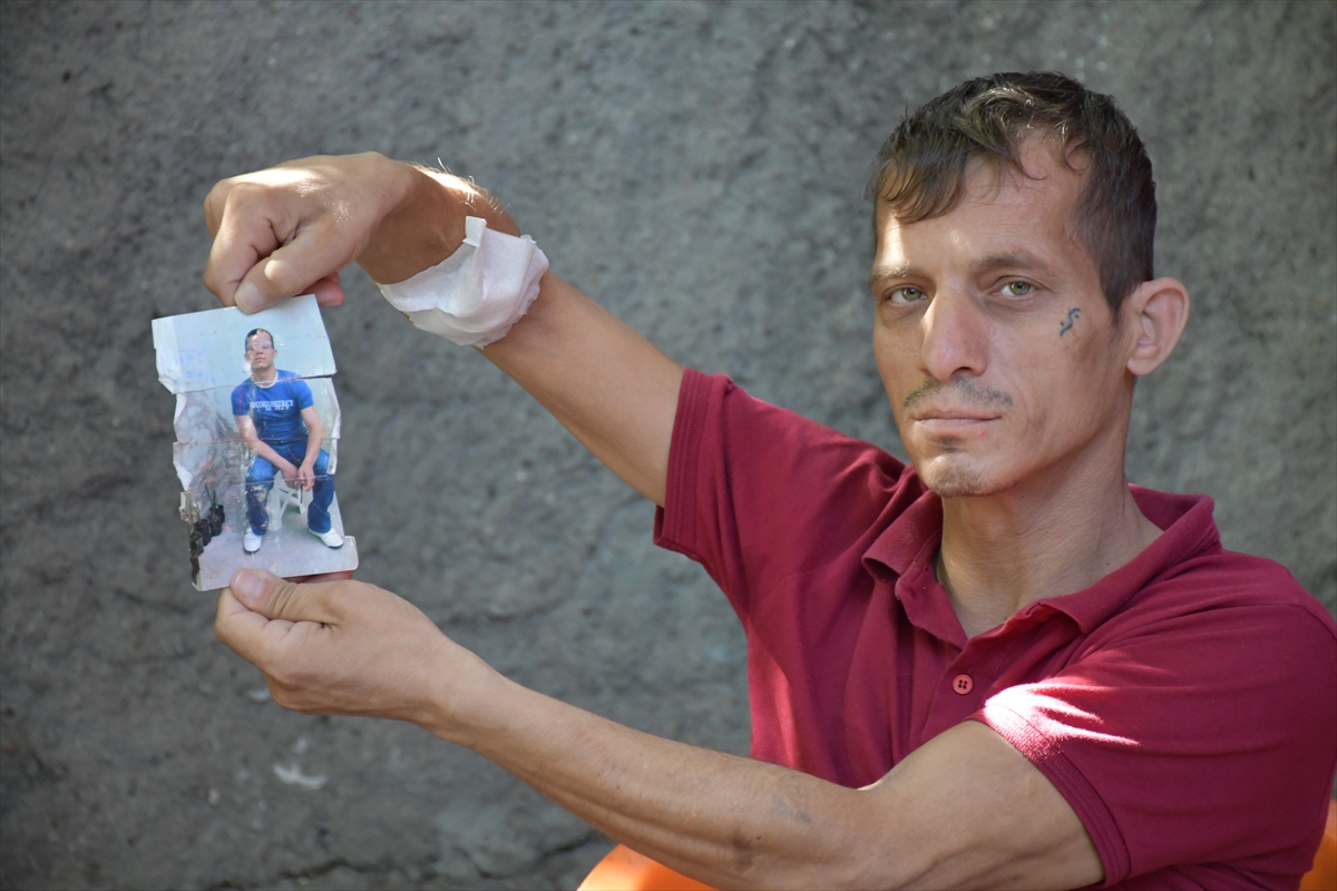 Adana'da diyalize giren 3 kardeş böbrek nakli olacakları günü umutla bekliyor